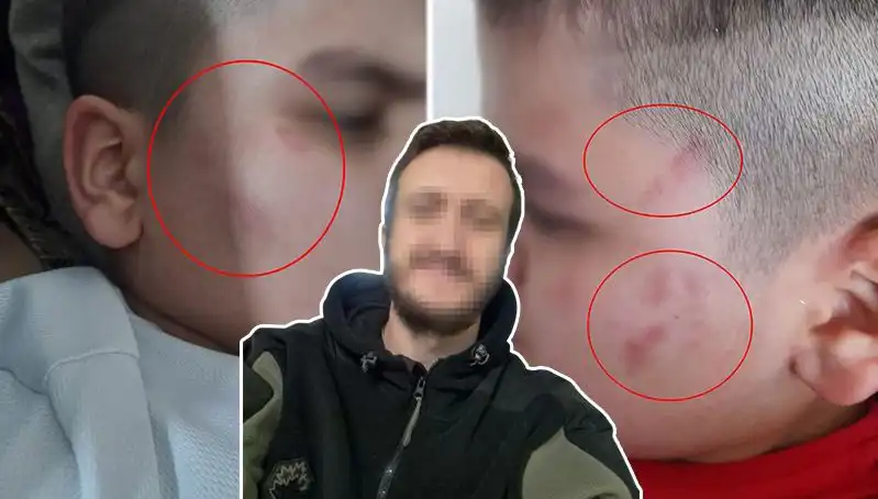 Otizmli Çocuğa Okulda Dayak İddiası: Aile ve Eğitim Kurumları Ne Yapmalı?