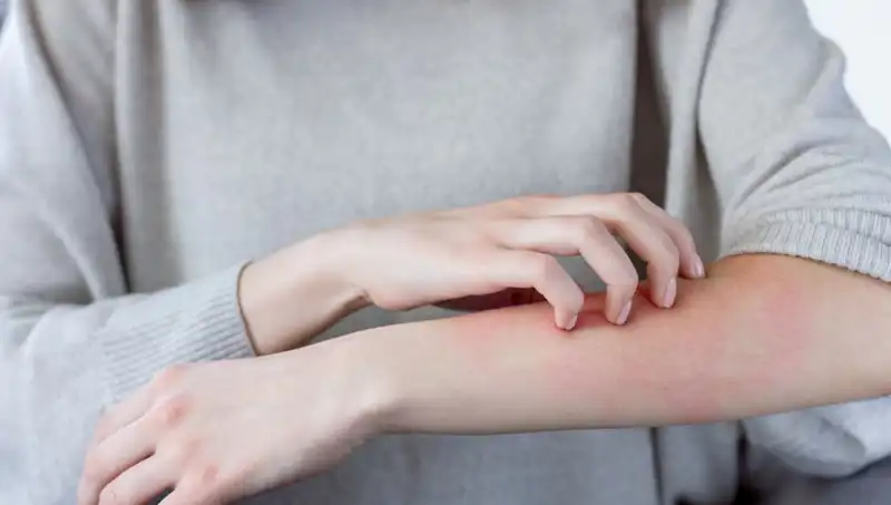 Cilt Kanserinin İki Gizli Belirtisi: Dermatologun Önemli Uyarısı